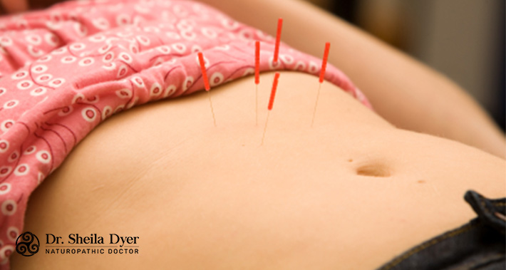 acupuncture and other naturopathic treatments for SIBO | Dr. Sheila Dyer Naturopathic Doctor | Yorkville Naturopath Clinic