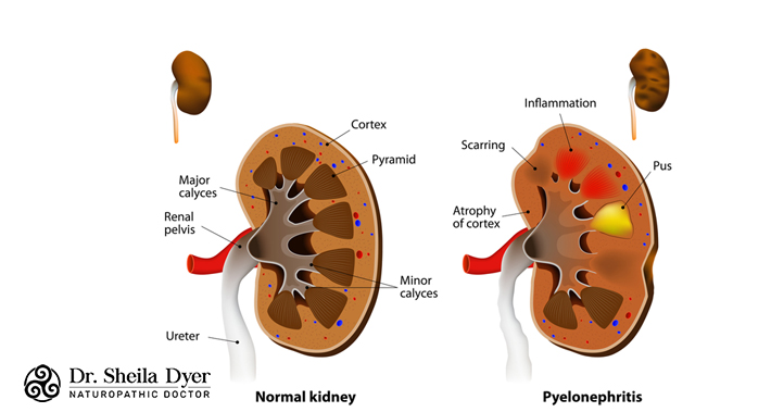 what your urine says about your kidney function | Dr. Sheila Dyer, ND | Naturopathic Doctor in Toronto