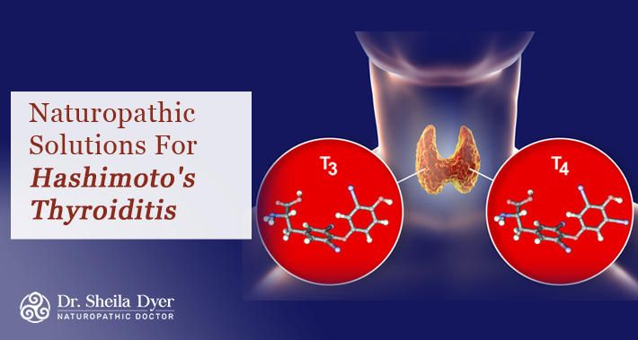 Naturopathic Treatments For Hashimoto's Thyroiditis | Dr. Sheila Dyer, ND | Toronto Naturopath